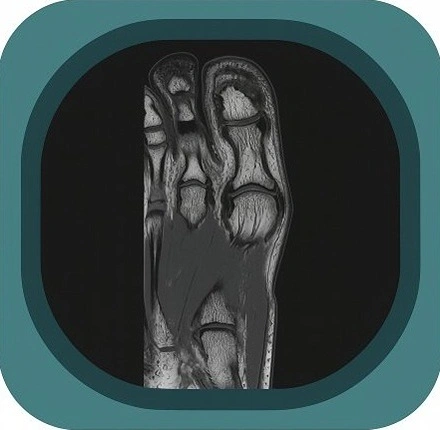 MRI great toe anatomy icon